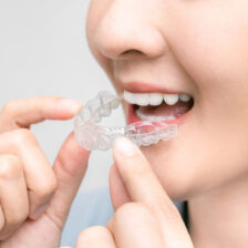 成田市公津の杜の歯医者、はばたき矯正・こどもも歯科